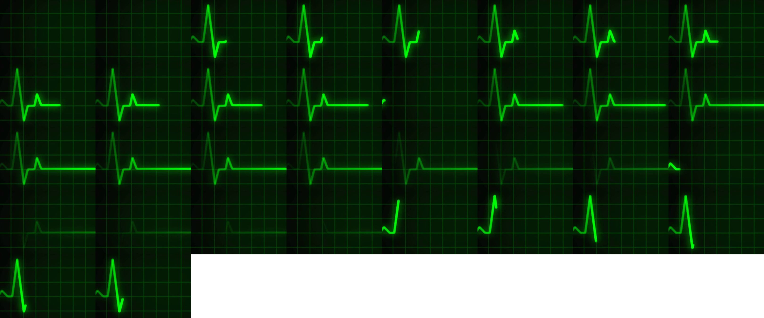 heart_loopspritesheet – Miraklet i Ånnsjön